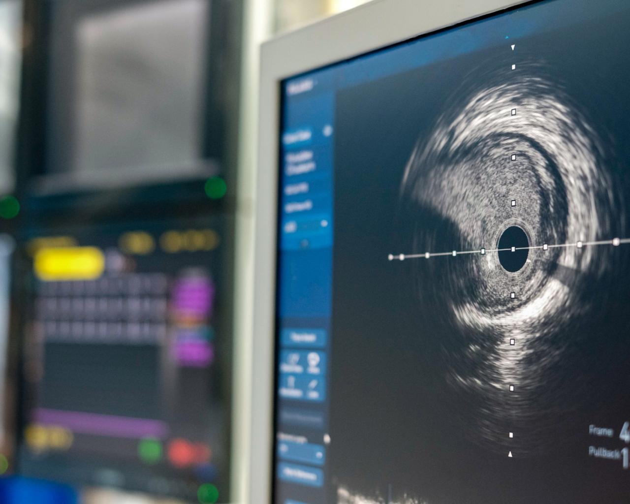 imagem de um cateterismo