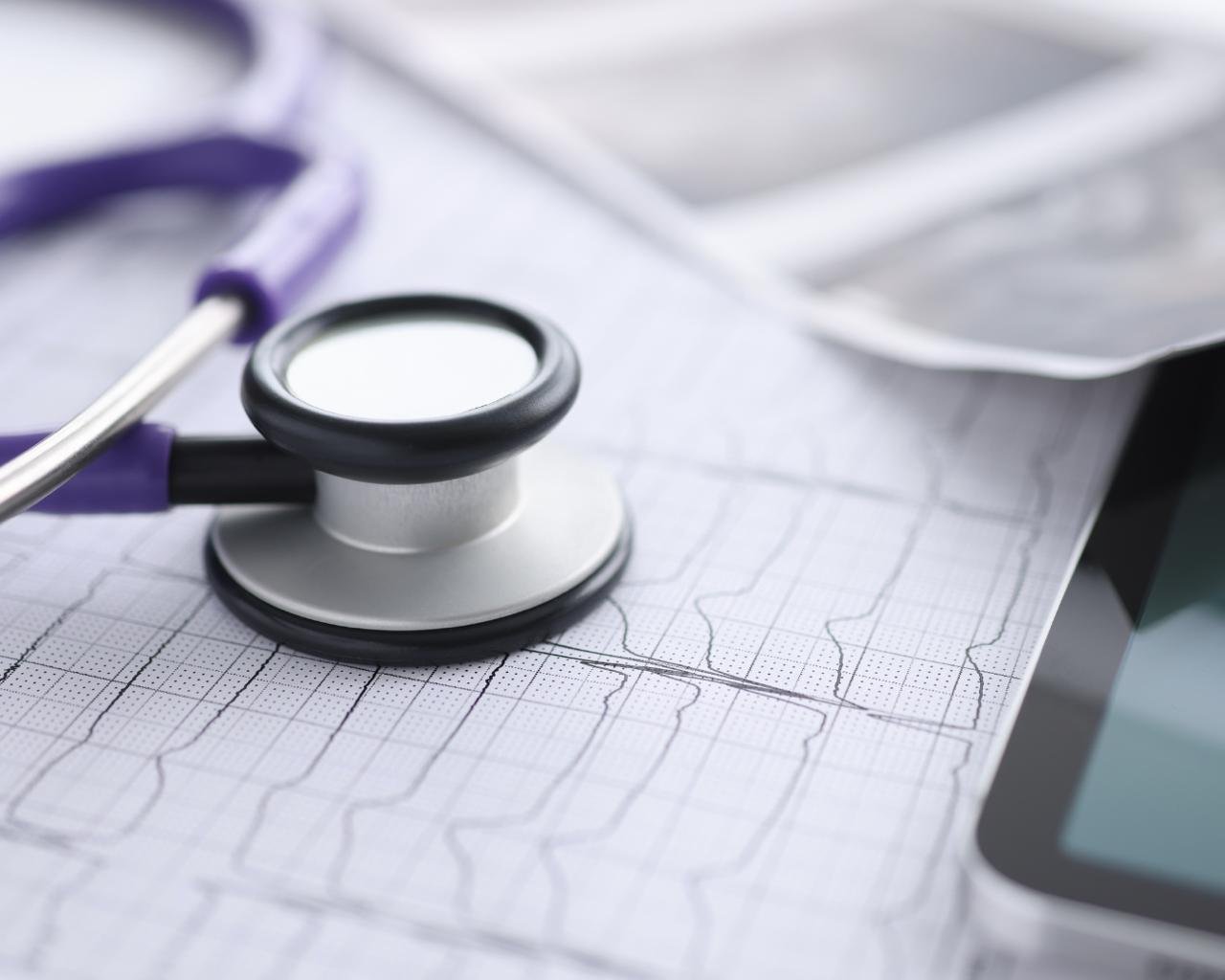 um estetoscopio em cima de um resultado de eletrocardiograma