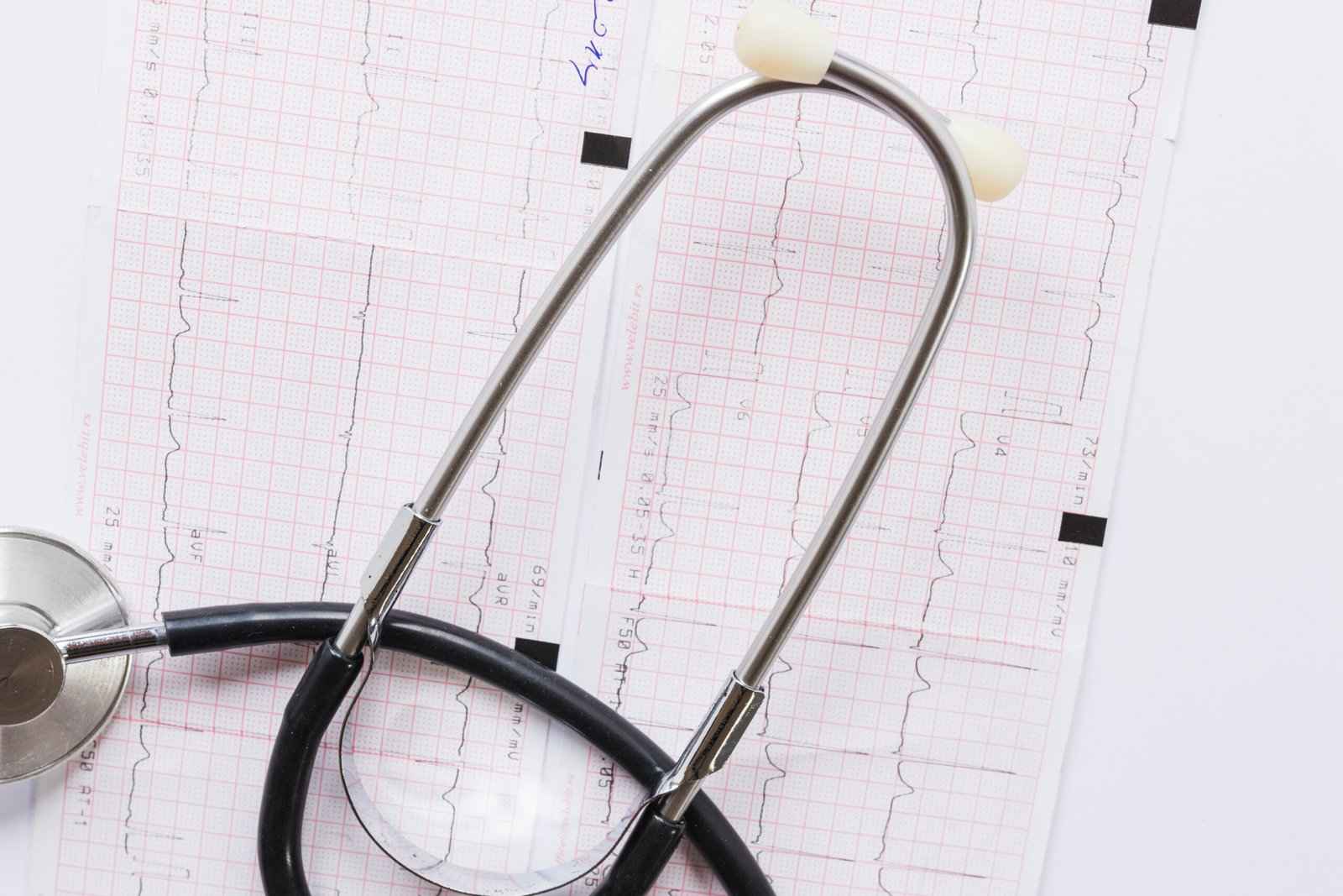 exame de eletrocardiograma 