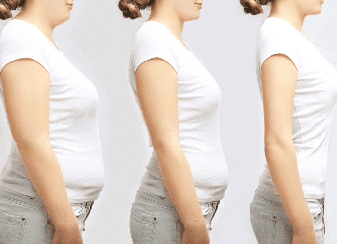 imagem mostra as fases de emagrecimento de uma mulher