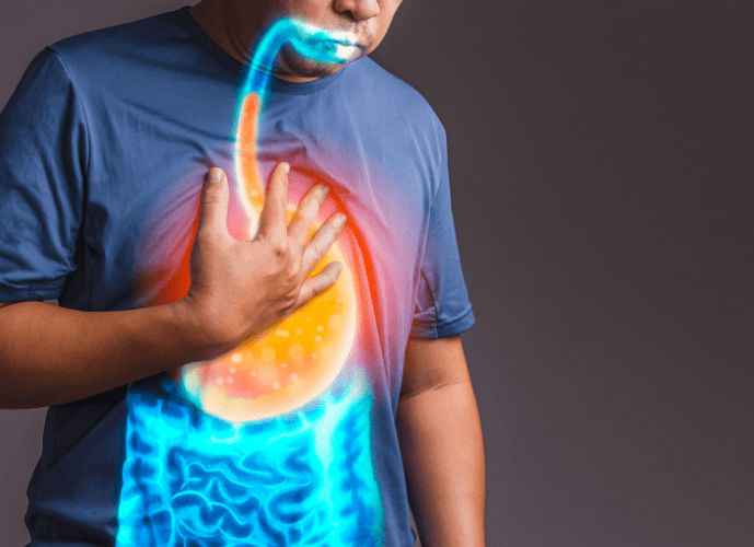 a imagem mostra um homem com refluxo, confusão comum com dor no peito ou infarto